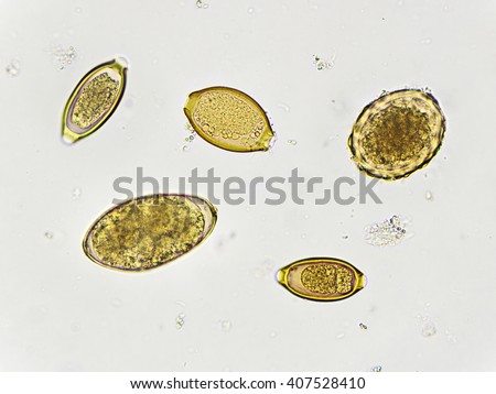 Egg Of Helminth In Stool, Analyze By Microscope Stock Photo 407528410 ...