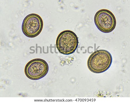 Eggs Of Taenia In Stool, Analyze By Microscope Stock Photo 470093459 ...