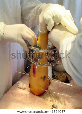hands of surgeons and patient during the operation