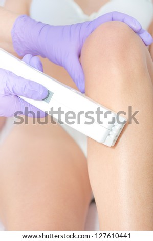 Laser hair removal