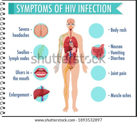 Symptoms of HIV infection infographic illustration