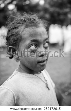 AKSUM, ETHIOPIA - SEP 27, 2011: Portrait of an unidentified Ethiopian cute girl in a yellow shirt in Ethiopia, Sep.27, 2011. Children in Ethiopia suffer of poverty due to the unstable situation