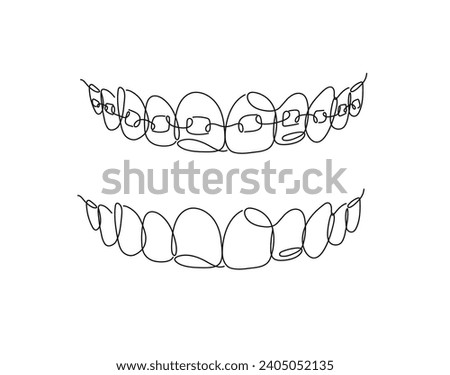 Jaws with and without braces installed drawing in flat line style on white background