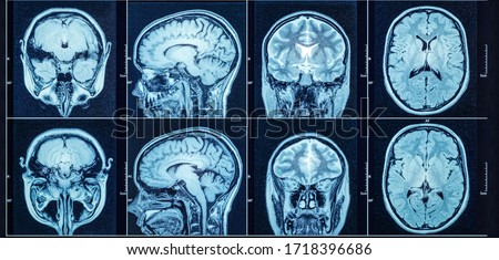 Closeup of a CT scan with brain. Medical, science and education mri brain background. Magnetic resonance imaging. ストックフォト © 