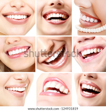 Perfect Smiles. Collection Of Beautiful Wide Human Smile With Great ...