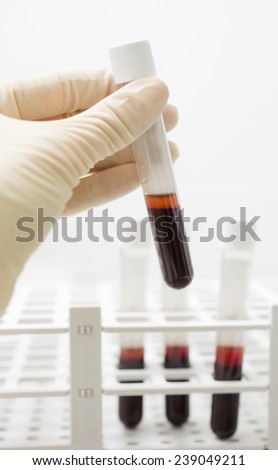Blood tests. Lab. Medical doctor holding a sterile tube with a blood test. takes from the set