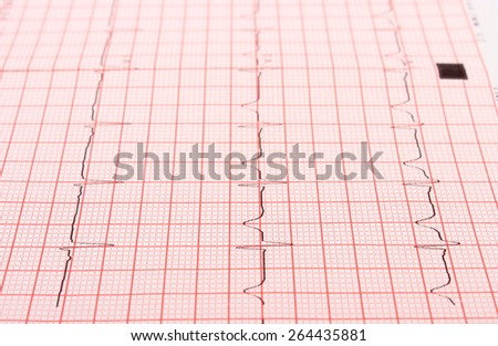 Electrocardiogram graph ekg heart rhythm, medicine concept