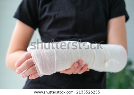 Close-up of a broken arm of a child in a cast. The girl holds her hand bent on the background of a black t-shirt. ストックフォト © 