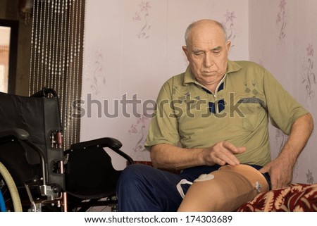 Elderly man fitting a prosthetic leg or artificial limb as he sits on his bed alongside his wheeelchair after an above knee amputation due to an accident or disease