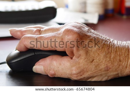 Living with pain series. Woman with rheumatoid arthritis using a computer mouse.