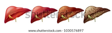 Different stages of human liver illustration