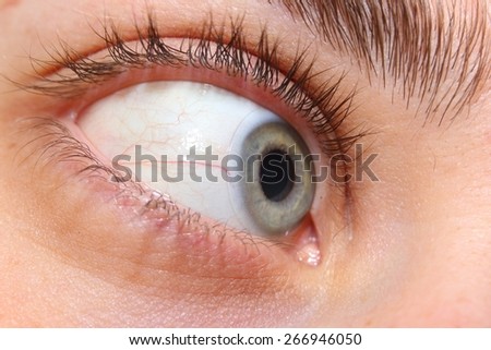 contact lenses into the eye