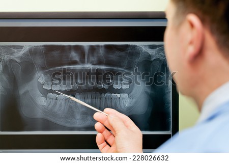 Dentist looking teeth on digital X-Ray computer monitor
