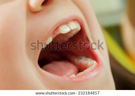 Close-up of patients open mouth during oral checkup with mirror near by