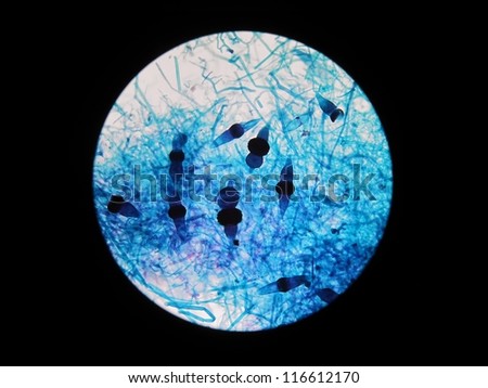Microscopic view of fungi - sexual reproduction