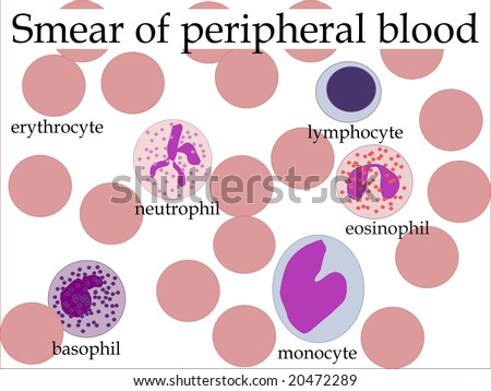 Smear Of Peripheral Blood - As Seen Under Microscope Stock Photo ...