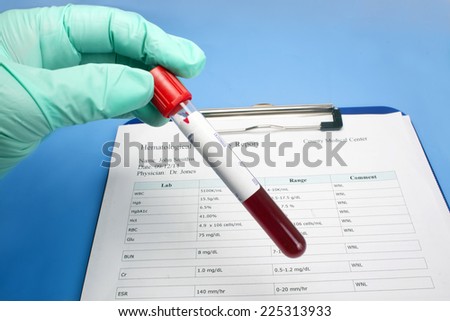 Medical technician holds hematology lab panel blood sample tube with patient hematology report.