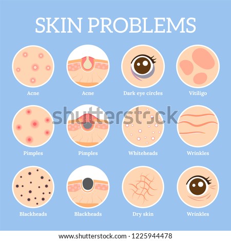 Skin problems. Ages wrinkles problem, face skin infection treatment and dark circles under eyes or black head pores, acne problems. Dermatology health vector icons set