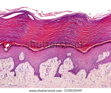 Keratinized Stratified Squamous Epithelium Of The Human Glabrous Skin ...