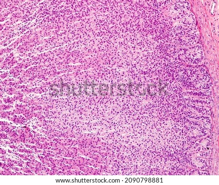 Light micrograph of the adrenal cortex showing, from right to left, the zona glomerulosa, the wide zona fasciculata, and the zona reticularis in which the sinusoidal capillaries are more dilated. Foto stock © 