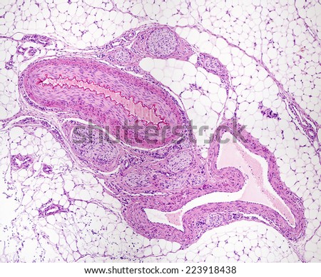 Muscular artery, vein and nerve bundles surrounded by adipose tissue. The artery is identified as having a thicker wall and a smaller diameter than the vein. Light microscope micrograph. H&E stain