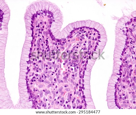 Simple Columnar Epithelium Of Uterine Cervix. The Epithelium Is Formed ...