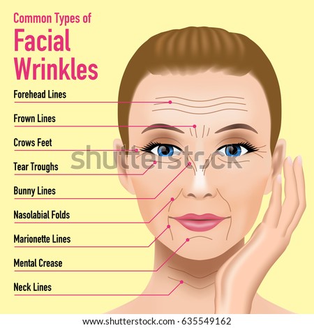 Common Types of Facial Wrinkles. cosmetic surgery. woman facial treatment concept.