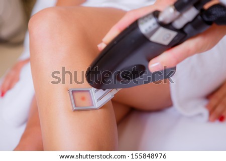 cosmetic procedures. laser hair removal