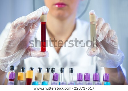 Medical test tube samples in doctor\'s hand