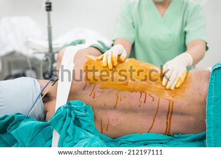 scrub nurse scrub patient prepare for chest operation