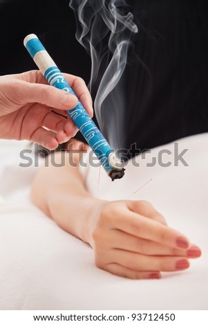 TCM Traditional Chinese Medicine, hand applying moxa stick