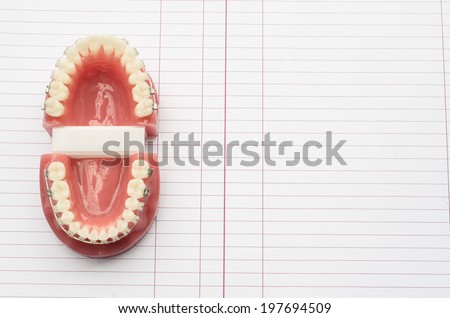 Dental model on chart