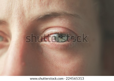 Close up on a woman\'s bloodshot crying eyes