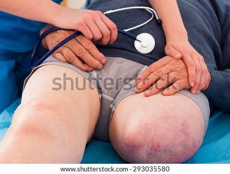 Elderly man with amputated leg getting the best medical care from kind doctor.