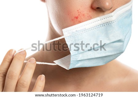 Young woman with prevention mask and skin irritation on white background. Maskne - acne breakouts from wearing a face mask.