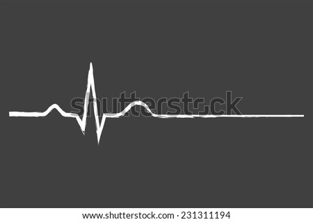 Electrocardiogram Last Life Sign On Blackboard