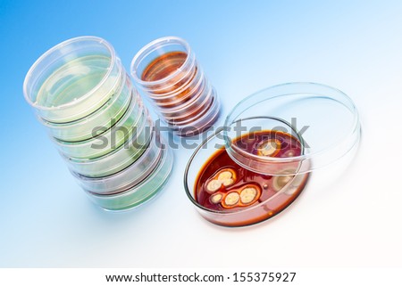 Mold growing in a Petri dish, on blue background