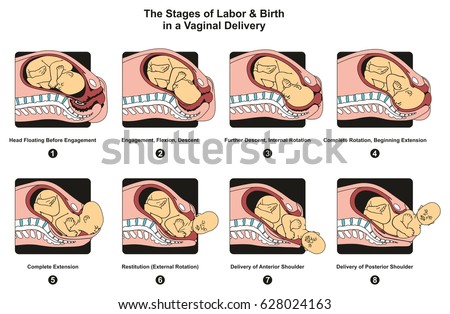 Stages of Labor and Birth in a vaginal delivery infographic diagram including engagement descent internal complete rotation extension poster for medical science education and healthcare
