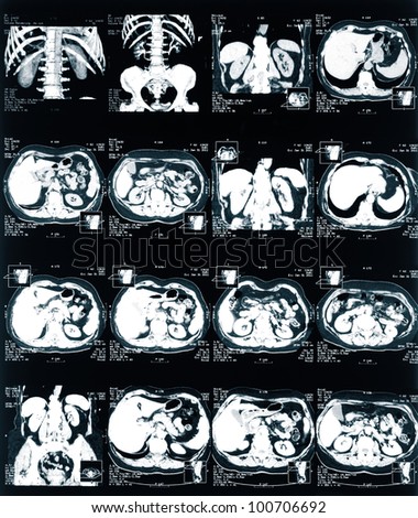 MRI.  X-ray of the pelvis and spinal column