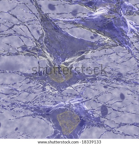 Depicts cancerous Tumor cells within the brain. Excellent for medical presentations or diagrams.