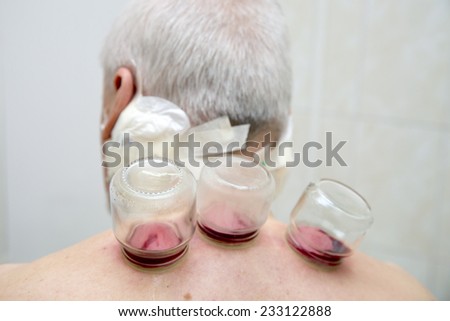 senior man with vacuum cups