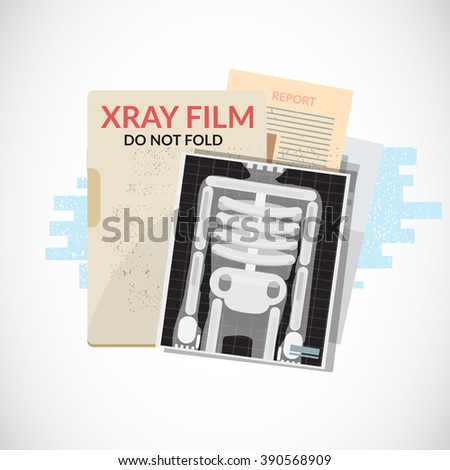 Human X-Ray film with paper and folder. Medical objects, file and document - vector illustration