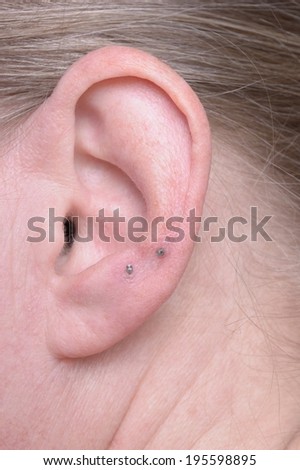 ear with longtime acupuncture