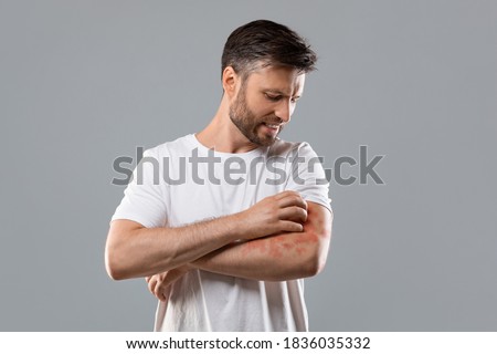 Dermatitis, eczema, allergy, psoriasis concept. Annoyed middle-aged man in white t-shirt scratching itch on his arm, grey studio background. Bearded man itching rash on his elbow, copy space Foto d'archivio © 