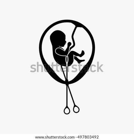 Abortion Is Personal Decision. Embryo with scissors. Flat vector illustration. Abortion sign, Abortion illustration, Abortion icon, Abortion isolated, Abortion image, Abortion vector