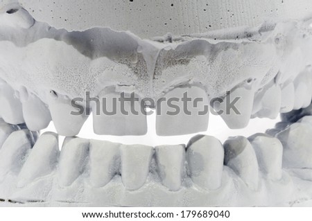 tooth impression