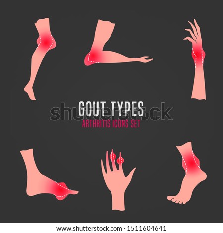 Gout arthritis icons set. Joint pain in human foot, leg, wrist, ankle, hand, arm. Editable vector illustration in pink and red colors isolated on grey background. Modern flat style. Graphic design