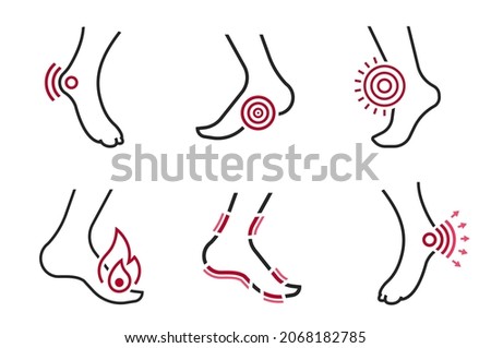 Foot inflammation, pain, angriness sign. Editable vector illustration in modern outline style isolated on a white background. Medical concept. Symbol, pictogram, icon, logotype element. Foto stock © 