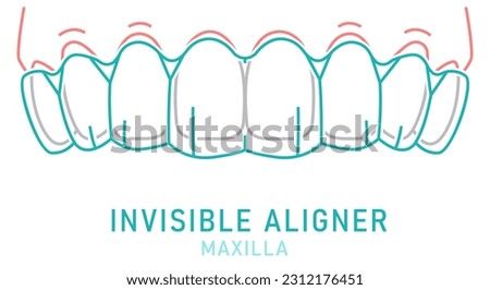 Orthodontic silicone trainer. Invisible braces aligner, retainer. Medical scheme. Inside view. Upper jaw. Horizontal poster. Editable vector illustration isolated on a white background.