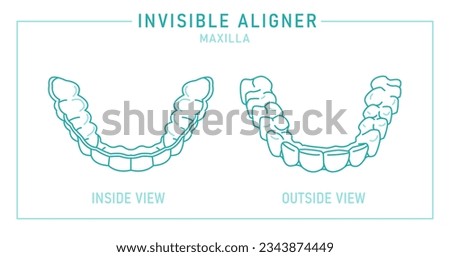 Orthodontic silicone trainer. Invisible braces aligner, retainer. Medical scheme in outline style. Outside, inside view. Upper jaw. Maxilla. Editable vector illustration isolated on a white background